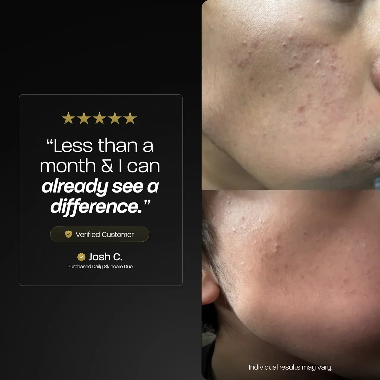 BASED Hidratante Facial Diario - vista en detalle para hombres Reino Unido